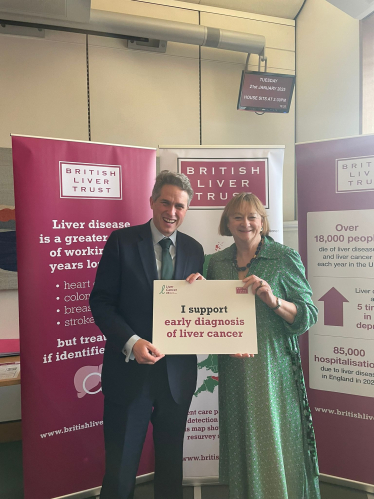 Gavin attends Parliamentary Love your Liver event